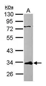 Anti-ETV7 antibody [N3C3] used in Western Blot (WB). GTX116171