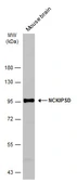 Anti-NCKIPSD antibody [C1C3] used in Western Blot (WB). GTX116172