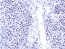 Anti-PIASy antibody used in IHC (Paraffin sections) (IHC-P). GTX116181