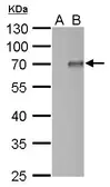 Anti-PIASy antibody used in Western Blot (WB). GTX116181