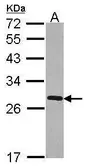 Anti-FKBP7 antibody [N1C3] used in Western Blot (WB). GTX116186