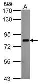 Anti-CPSF73 antibody used in Western Blot (WB). GTX116187
