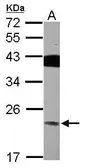 Anti-VPS29 antibody used in Western Blot (WB). GTX116189