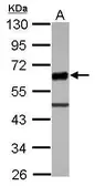 Anti-UBASH3A antibody used in Western Blot (WB). GTX116201