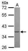 Anti-MBD3 antibody [N1C3] used in Western Blot (WB). GTX116204