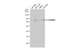 Anti-ADAM22 antibody [N1N2], N-term used in Western Blot (WB). GTX116206