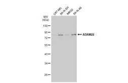 Anti-ADAM22 antibody [N1N2], N-term used in Western Blot (WB). GTX116206