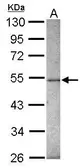 Anti-ZNF213 antibody [N1C1] used in Western Blot (WB). GTX116215