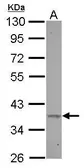 Anti-BXDC2 antibody [N2C3] used in Western Blot (WB). GTX116224