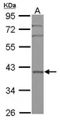 Anti-BXDC2 antibody [N1C2] used in Western Blot (WB). GTX116225