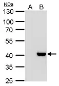 Anti-Macro H2A.2 antibody [N3C3] used in Western Blot (WB). GTX116234