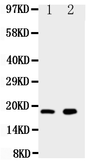 Anti-Ly6al antibody used in Western Blot (WB). GTX11624