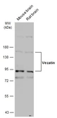 Anti-Vezatin antibody used in Western Blot (WB). GTX116240