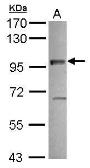 Anti-Vezatin antibody used in Western Blot (WB). GTX116240
