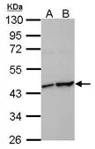 Anti-HIF1AN antibody used in Western Blot (WB). GTX116251