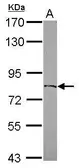 Anti-ZFP64 antibody [N1C1] used in Western Blot (WB). GTX116259