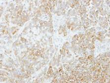 Anti-VPS35 antibody used in IHC (Paraffin sections) (IHC-P). GTX116260