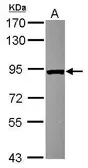 Anti-VPS35 antibody used in Western Blot (WB). GTX116260