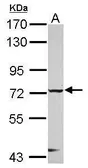 Anti-CHFR antibody [C1C3] used in Western Blot (WB). GTX116262