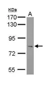 Anti-RC74 antibody [C1C3] used in Western Blot (WB). GTX116266