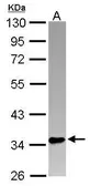 Anti-PINX1 antibody [N1C2] used in Western Blot (WB). GTX116274