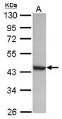 Anti-PAK1 interacting protein 1 antibody [N1C1] used in Western Blot (WB). GTX116276