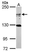Anti-USP47 antibody [C3], C-term used in Western Blot (WB). GTX116278