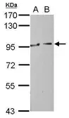 Anti-MOCOS antibody [N1N3] used in Western Blot (WB). GTX116279