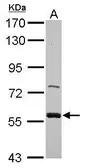 Anti-ZWILCH antibody [C1C3] used in Western Blot (WB). GTX116280