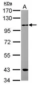 Anti-RFWD3 antibody [C1C3] used in Western Blot (WB). GTX116292