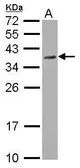 Anti-P15RS antibody used in Western Blot (WB). GTX116296
