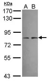 Anti-DIP13B antibody [N1N3] used in Western Blot (WB). GTX116298