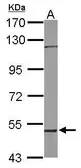 Anti-RCBTB1 antibody [N1C1] used in Western Blot (WB). GTX116302