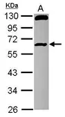 Anti-RCBTB1 antibody [N1C1-2] used in Western Blot (WB). GTX116303