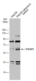Anti-STEAP3 antibody [N1C1] used in Western Blot (WB). GTX116308