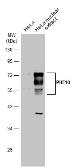 Anti-PHF10 antibody used in Western Blot (WB). GTX116314