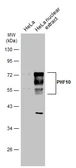 Anti-PHF10 antibody used in Western Blot (WB). GTX116314
