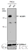 Anti-4E-BP1 antibody [N1C3-2] used in Western Blot (WB). GTX116315