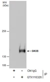Anti-SIN3B antibody [N1N2], N-term used in Immunoprecipitation (IP). GTX116326