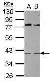 Anti-RBM9 antibody [N2C3] used in Western Blot (WB). GTX116327