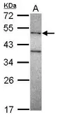 Anti-DNA polymerase mu antibody [N1C1] used in Western Blot (WB). GTX116332