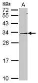 Anti-DDAH2 antibody [N2C3] used in Western Blot (WB). GTX116339