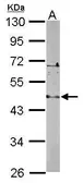 Anti-LDB2 antibody [N2C3] used in Western Blot (WB). GTX116344