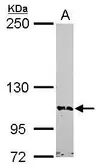 Anti-BRD1 antibody [N2C1], Internal used in Western Blot (WB). GTX116353