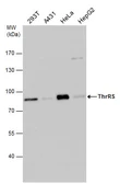 Anti-ThrRS antibody [N3C3] used in Western Blot (WB). GTX116359