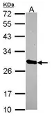Anti-HscB antibody [N1C3] used in Western Blot (WB). GTX116372