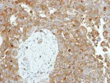Anti-CNDP2 antibody [N3C3] used in IHC (Paraffin sections) (IHC-P). GTX116375