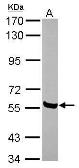 Anti-AMIGO1 antibody [N1N3] used in Western Blot (WB). GTX116384