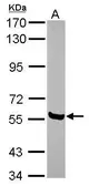 Anti-AMIGO1 antibody [N1N3] used in Western Blot (WB). GTX116384