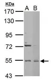 Anti-Edc3 antibody [N2C2], Internal used in Western Blot (WB). GTX116386